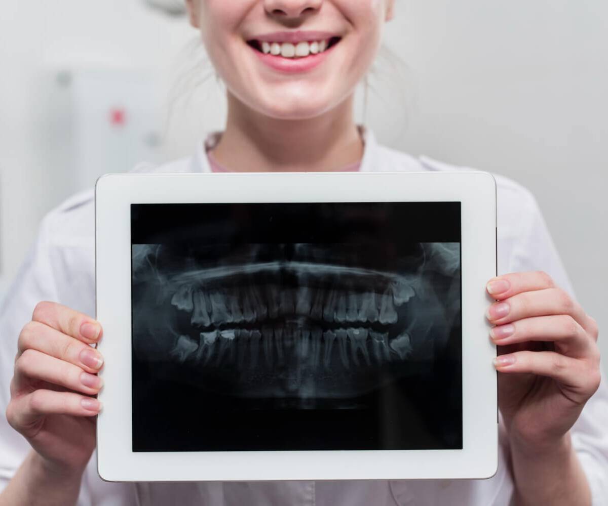 Dental Dijital Radyografi