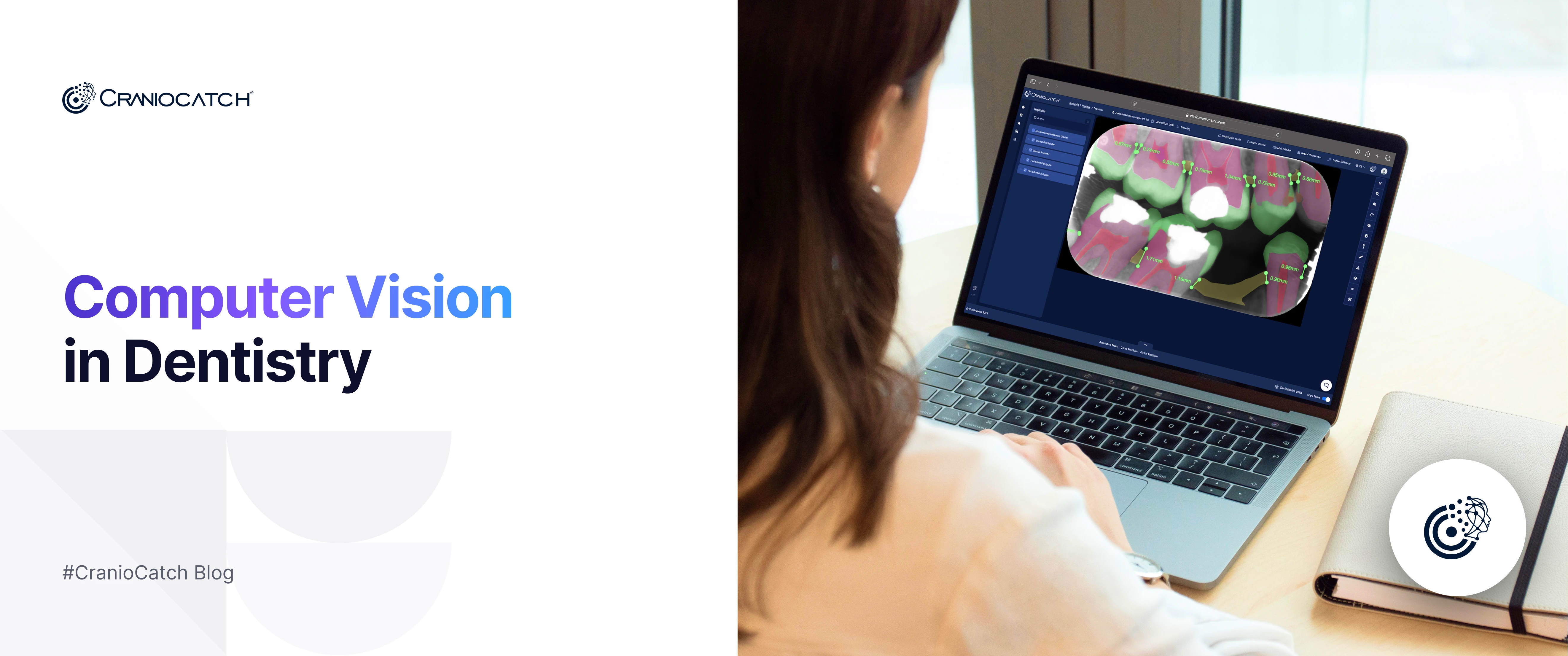 Diş Hekimliğinde Bilgisayarlı Görü: Yapay Zeka ile Teşhis