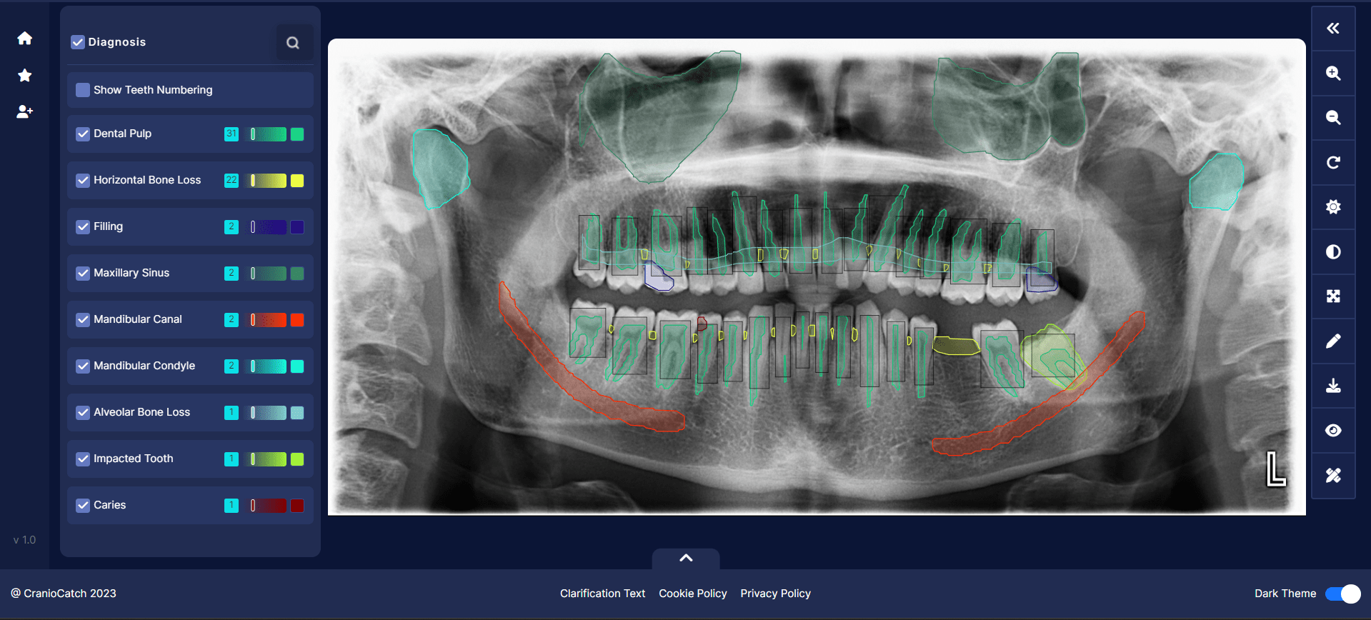 CranioCatch, dental turizme ivme kazandıracak!