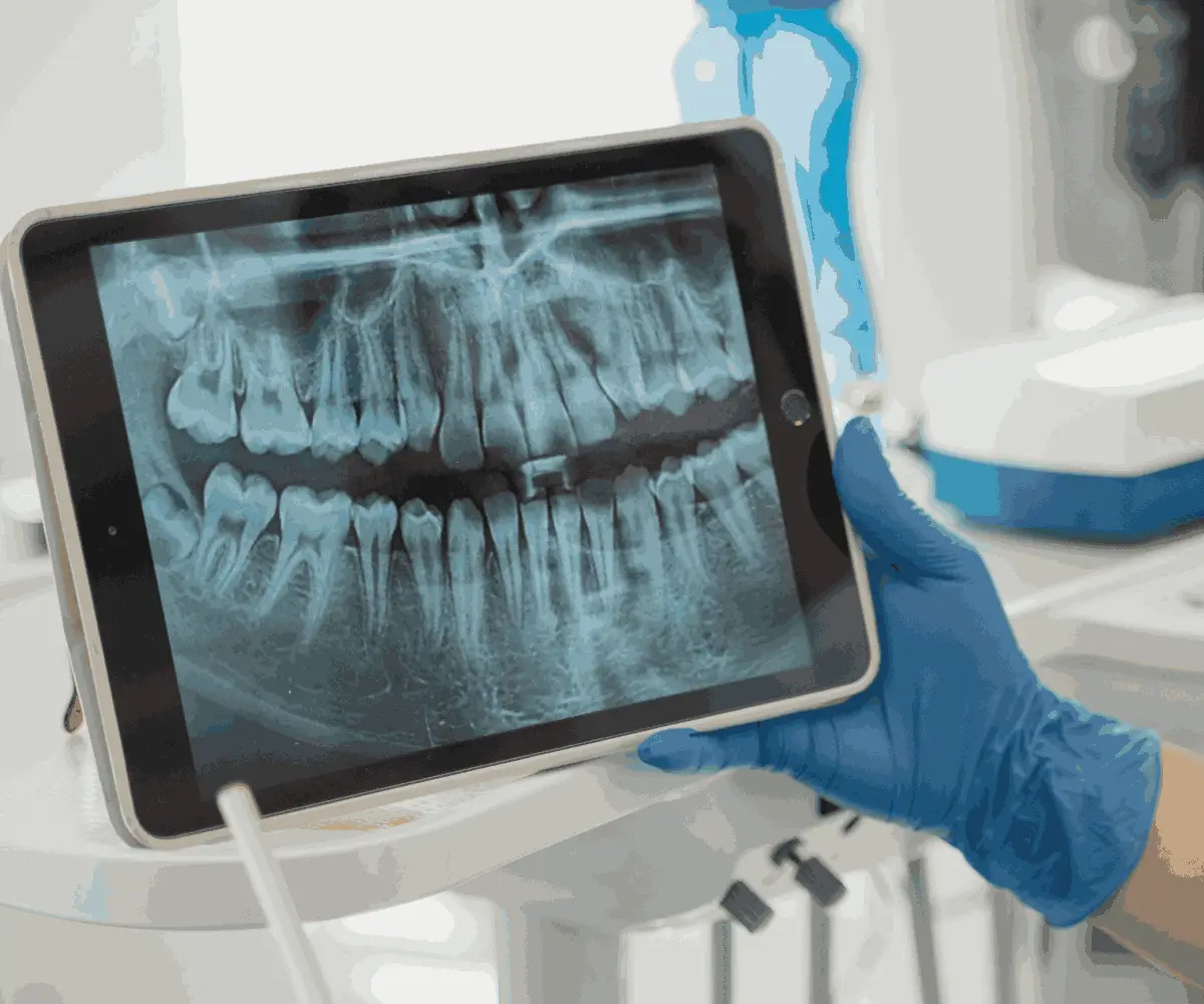 Dental Dijital Radyografi