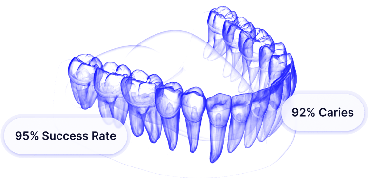 tooth