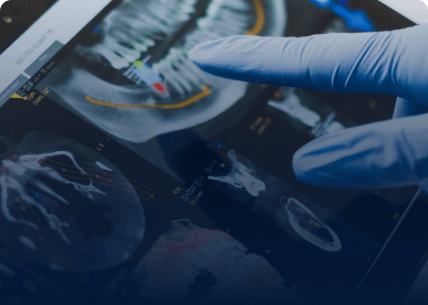  doktor radyografide   yapay zeka diş analizinin  teşhis ettiği problemleri parmağıla gösteriyor 